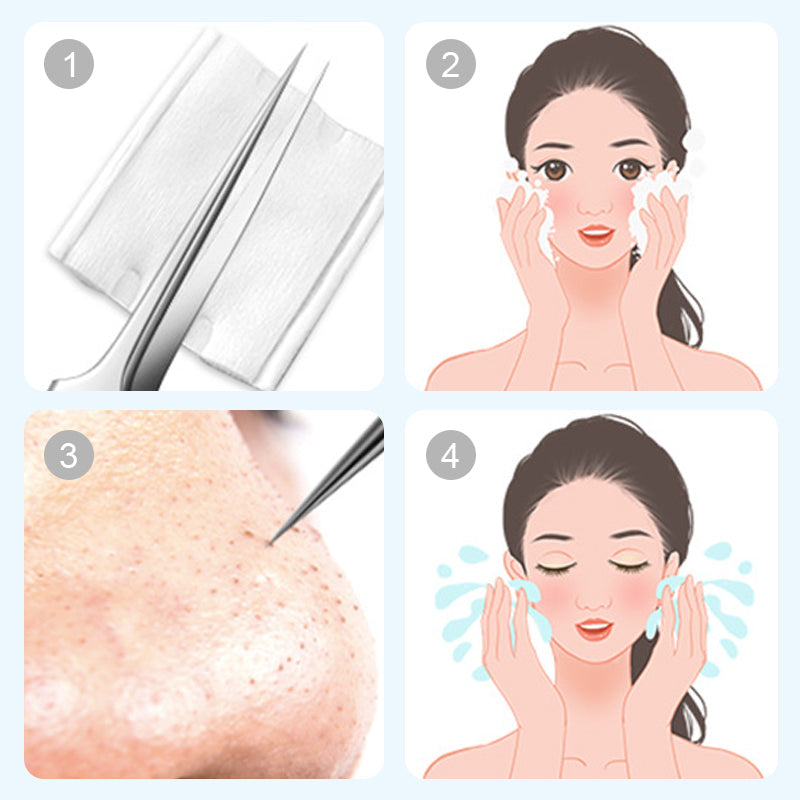 Medical Grade Blackhead Extraction Tool Kit